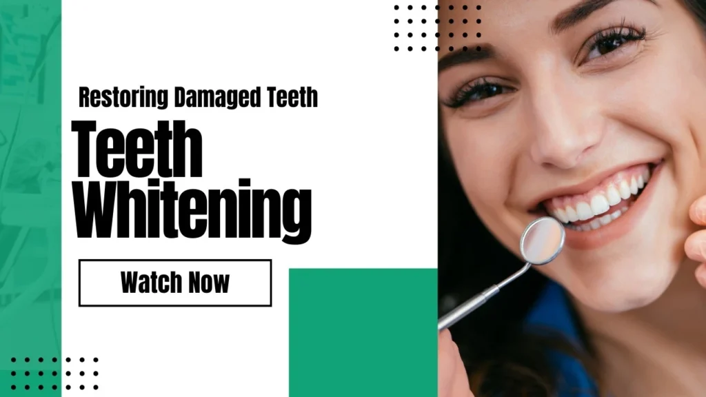 What Are The Options For People With Bad Teeth? Your Guide to a Healthier Smile